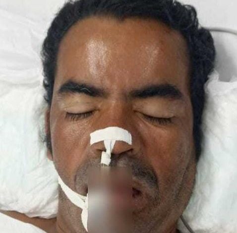 Photo of Conquista: Hospital Geral busca por familiares de paciente inconsciente e sem identificação